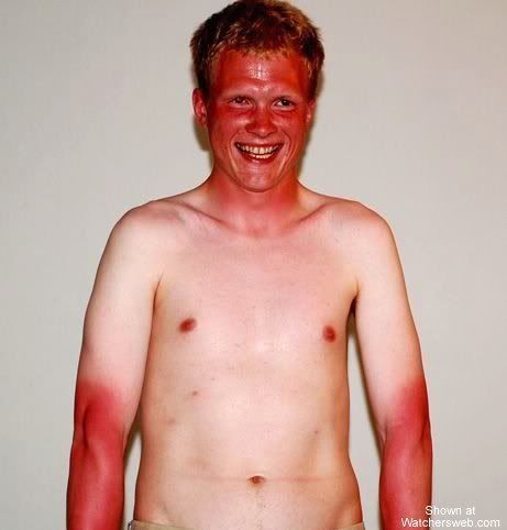 burnt.jpg
