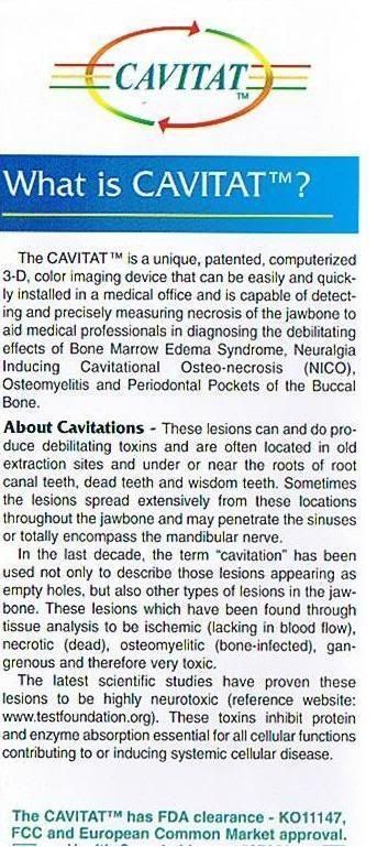Abscessed Tooth Symptoms, Pain,.