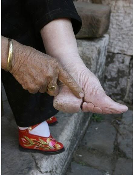 chinese foot